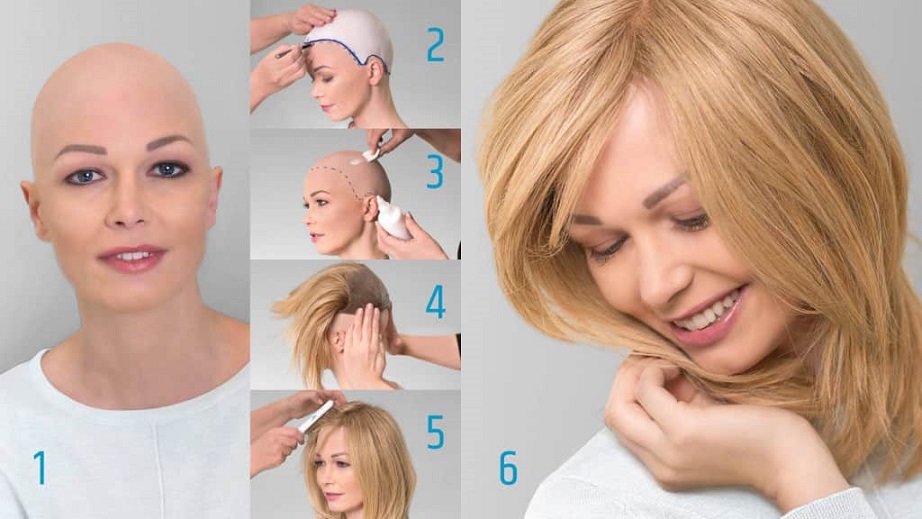 hair system for women